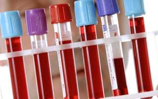 Лейкоплакия — причины возникновения у детей и взрослых, диагностика, локализация и методы лечения