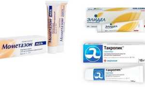 Атопический дерматит у детей и взрослых — причины, симптомы и лечение