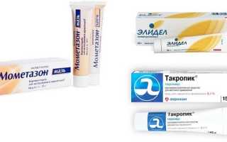 Атопический дерматит у детей и взрослых — причины, симптомы и лечение