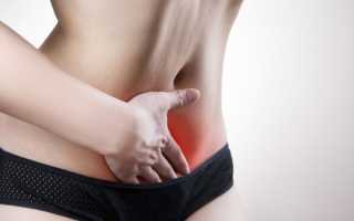 Воспаление придатков у женщин — симптомы, диагностика и лечение