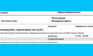 Волчаночный антикоагулянт: норма, отклонения и лечение