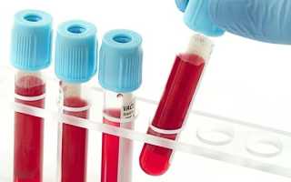 Клебсиелла – что это такое и пути передачи бактерии, симптомы, диагностика, лечение и профилактика