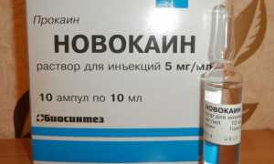 Что такое анестетики