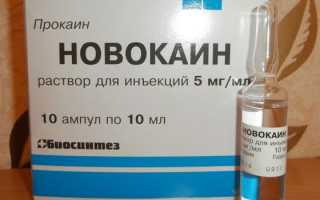 Что такое анестетики