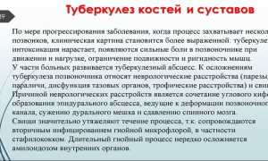 Туберкулез костей и суставов: симптомы и лечение