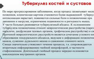 Туберкулез костей и суставов: симптомы и лечение