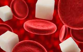 Почему может подниматься сахар при менопаузе?