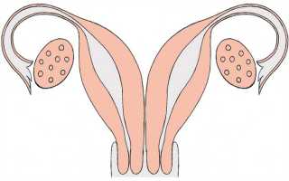Двойная матка и шансы на беременность