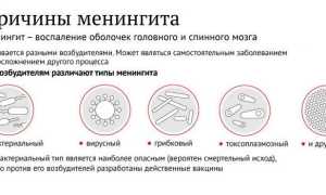Что такое менингит — причины, симптомы и лечение
