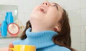 Грибковая ангина — причины и симптомы у детей и взрослых