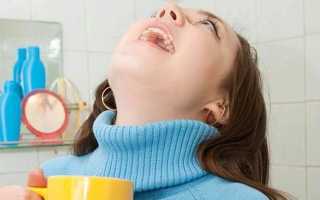 Грибковая ангина — причины и симптомы у детей и взрослых