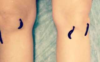 Гонартроз коленного сустава — причины и степени заболевания, лечение