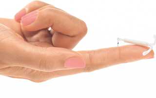 Можно ли ставить спираль при миоме матки, и какую?