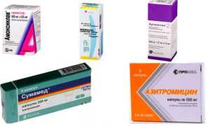 Острый средний отит у детей — лечение и клинические рекомендации