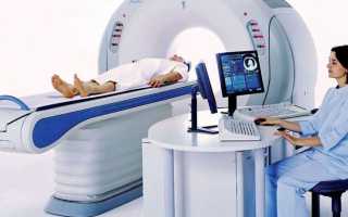 Сотрясение мозга — лечение у детей и взрослых, диагностика, первая помощь, способы терапии и осложнения