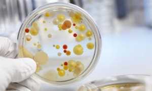 Диагностика вирусного гепатита С — первые признаки и проявления