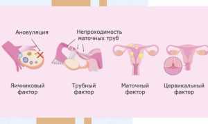 Почему не наступает беременность? 