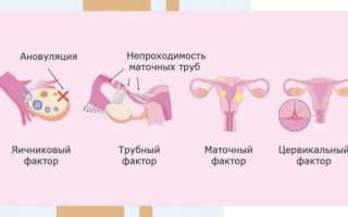 Почему не наступает беременность? 