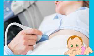 Два желтых тела на УЗИ: что это и в каких случаях возникают