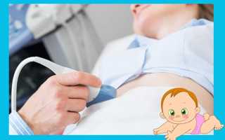 Два желтых тела на УЗИ: что это и в каких случаях возникают