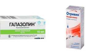 Гиперпластический ринит: симптомы и лечение заболевания