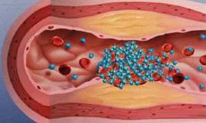 Тромбитал: инструкция по применению, аналоги, отзывы, цены