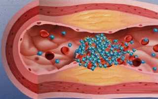 Тромбитал: инструкция по применению, аналоги, отзывы, цены