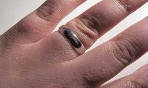 Почему отекают руки при беременности и что делать