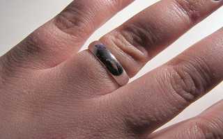 Почему отекают руки при беременности и что делать