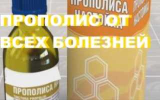 Эффективна ли настойка прополиса на спирту от грибка ногтей?