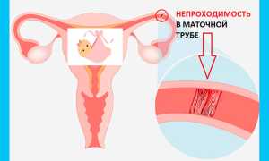 Как сдать анализ на бесплодие