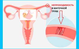 Как сдать анализ на бесплодие
