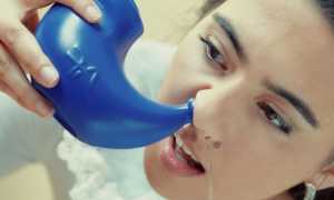 Верхнечелюстной синусит — что это такое: симптомы и лечение