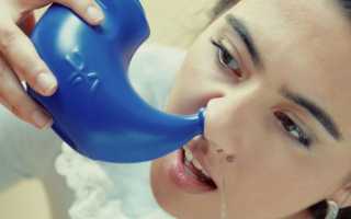 Верхнечелюстной синусит — что это такое: симптомы и лечение