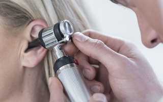 Жидкость в ухе — причины возникновения, симптомы, диагностика, методы лечения и осложнения