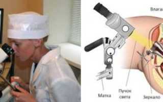 Кольпоскопия шейки матки: плюсы и минусы