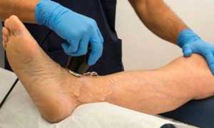 Артрит — что это за болезнь, причины и симптомы, диагностика, методы терапии и профилактика