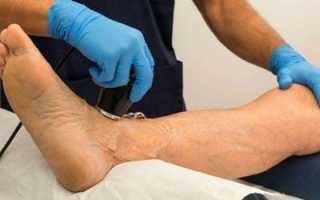 Артрит — что это за болезнь, причины и симптомы, диагностика, методы терапии и профилактика