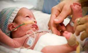 Лечение молочницы у новорожденных деток в ротовой полости