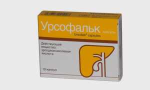 Перегиб шейки, тела и дна желчного пузыря