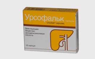 Перегиб шейки, тела и дна желчного пузыря