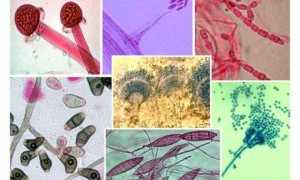 Как избавиться от грибка на мошонке