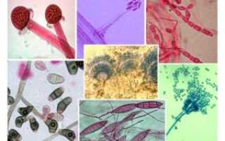 Как избавиться от грибка на мошонке