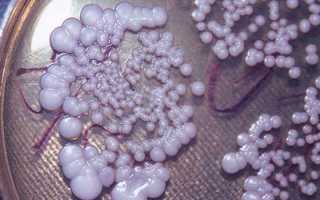 Как передается мышиная лихорадка — пути заражения и профилактика