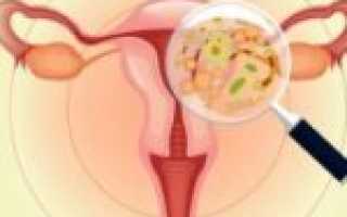 Есть ли вероятность, что молочница пройдет без лечения?