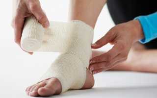 Первая помощь при вывихе сустава после травмы