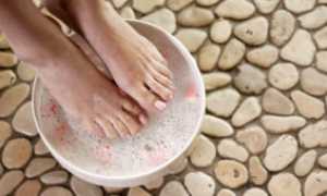 Как в домашних условиях вылечить грибок обыкновенной содой