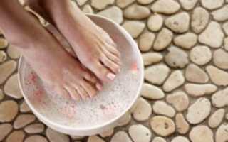 Как в домашних условиях вылечить грибок обыкновенной содой