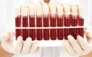 Норма прогестерона при беременности