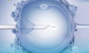 Мифы об ЭКО